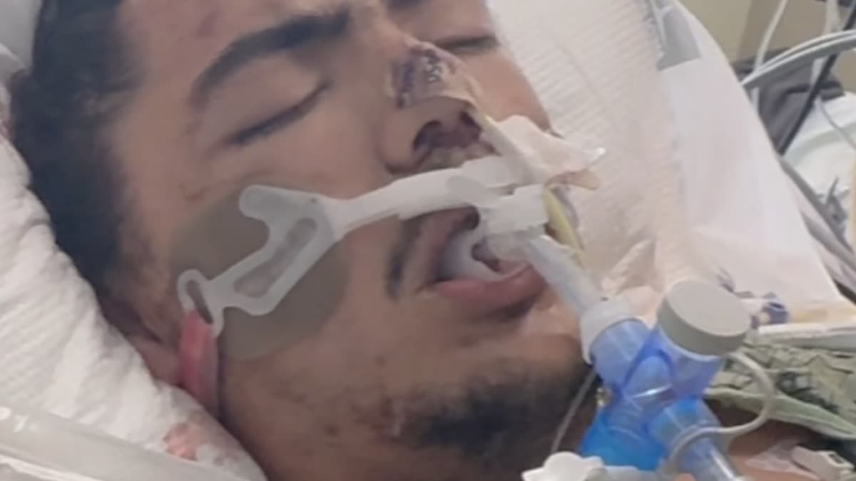 Lakeside Man Shows Signs of Recovery After Severe Motorcycle Crash